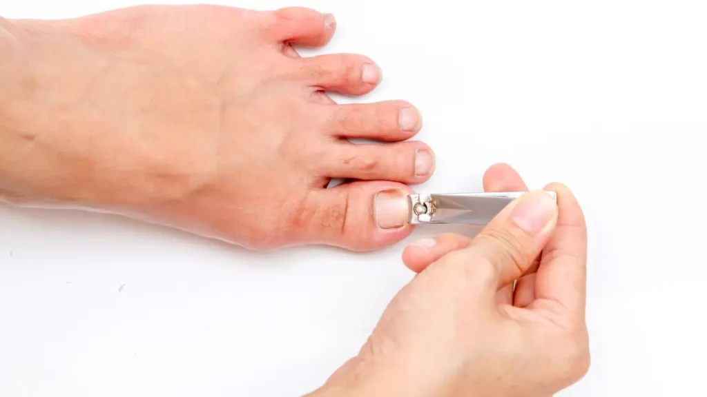 Toenails Cutting