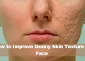 Grainy Skin Texture on Face