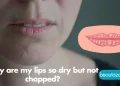 Why are my lips so dry but not chapped?