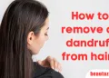 How to remove all dandruff from hair