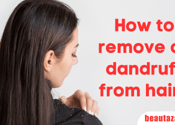 How to remove all dandruff from hair
