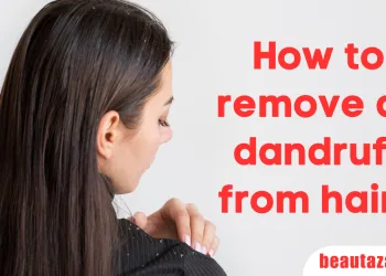 How to remove all dandruff from hair