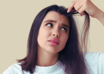 Aloe Vera for Dandruff – How to Use Aloe for a Healthier Scalp