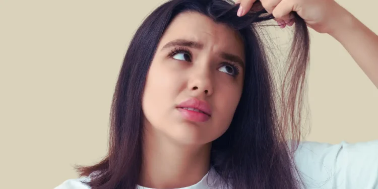 Aloe Vera for Dandruff – How to Use Aloe for a Healthier Scalp