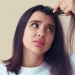 Aloe Vera for Dandruff – How to Use Aloe for a Healthier Scalp